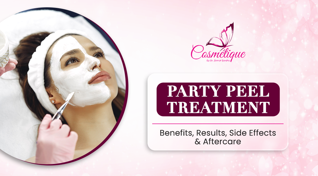 Party Peel Treatment: Benefits, Results, Side Effects & Aftercare